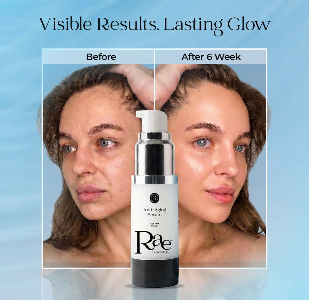 Rae Anti-Aging Serum for Wrinkles, Fine Lines & Firmness, Patented Formula for Smooth Radiant Skin